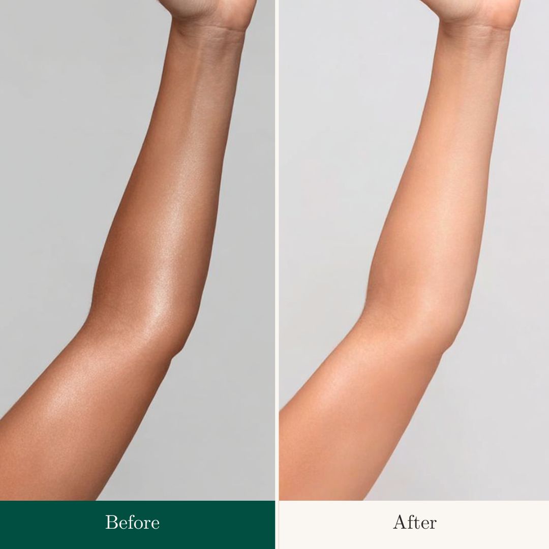 Before After 9